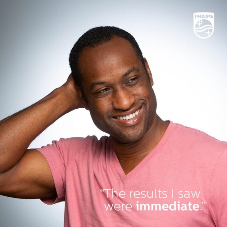 Photo of Man Smiling after Zoom Whitening